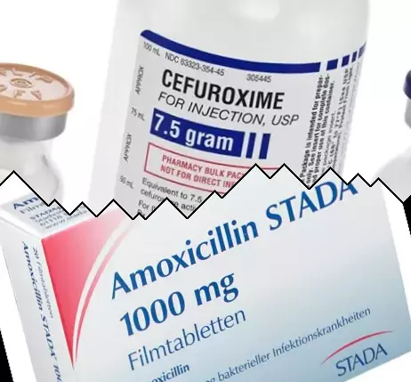 Cefuroxime vs Amoxicillin